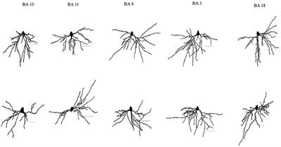 Basal Dendritic Morphology of Cortical Pyramidal Neurons in Williams Syndrome: Prefrontal Cortex and Beyond